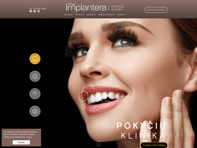 implantera.lt snapshot